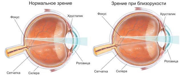 строение глаза