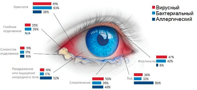 Глаза гноятся и красные может быть при аллергии