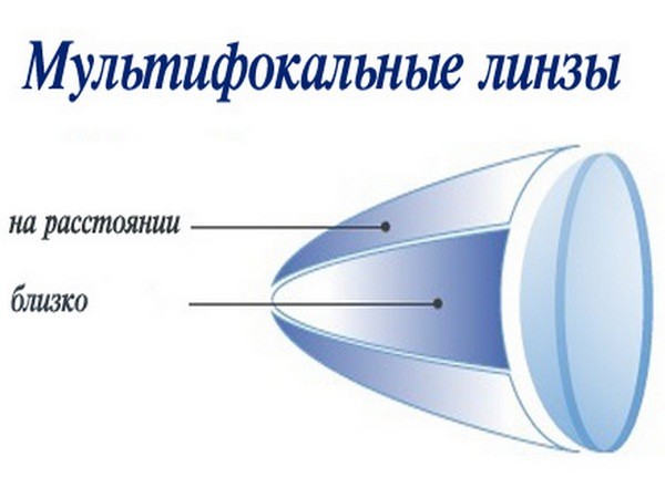 Мультифокальные линзы